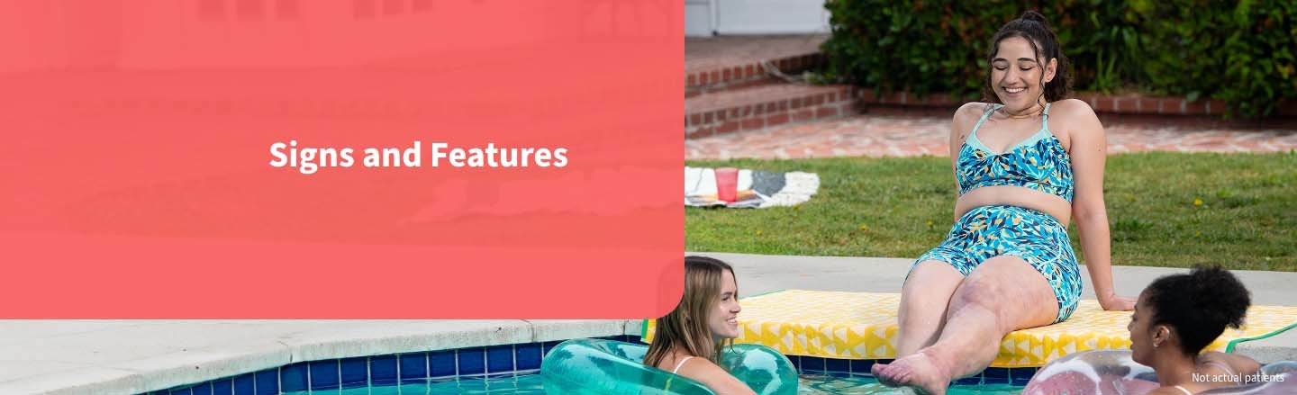 Image of teenagers hanging out by a pool. Text on image says “Signs and Features”